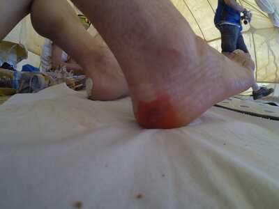 MDS, GOPR5298