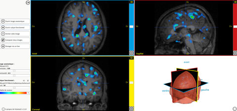 Images Atlas SVT, EduAnat2