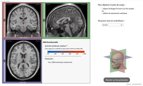 Images Atlas SVT, IRMVirtuelle