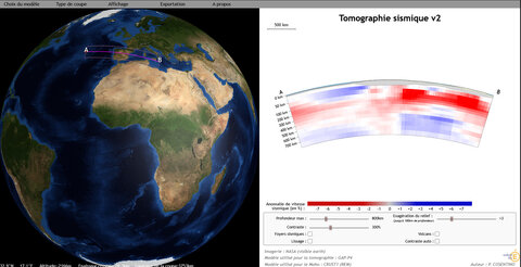 Images Atlas SVT, TomoV2